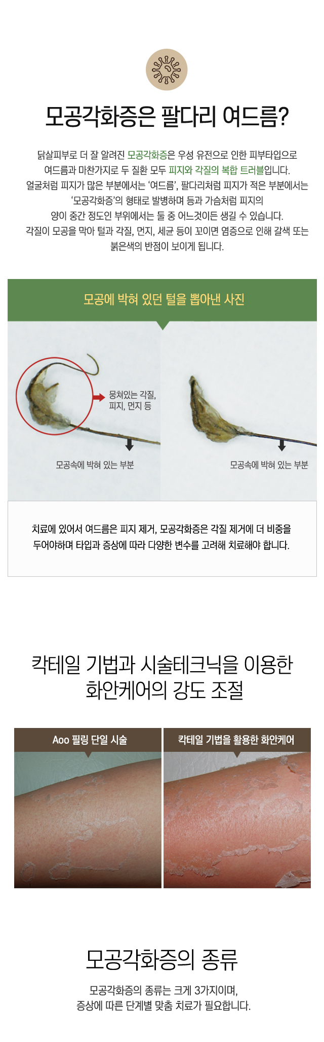 모공각화증