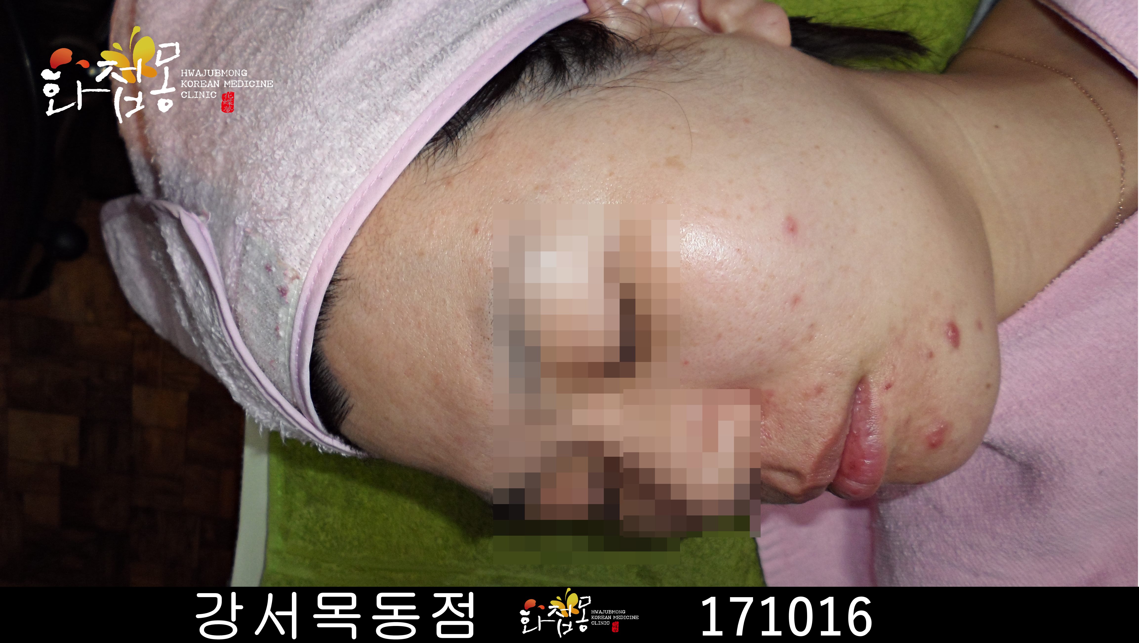 전후사진