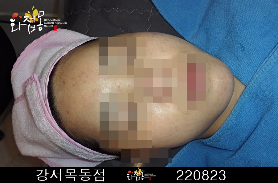 전후사진