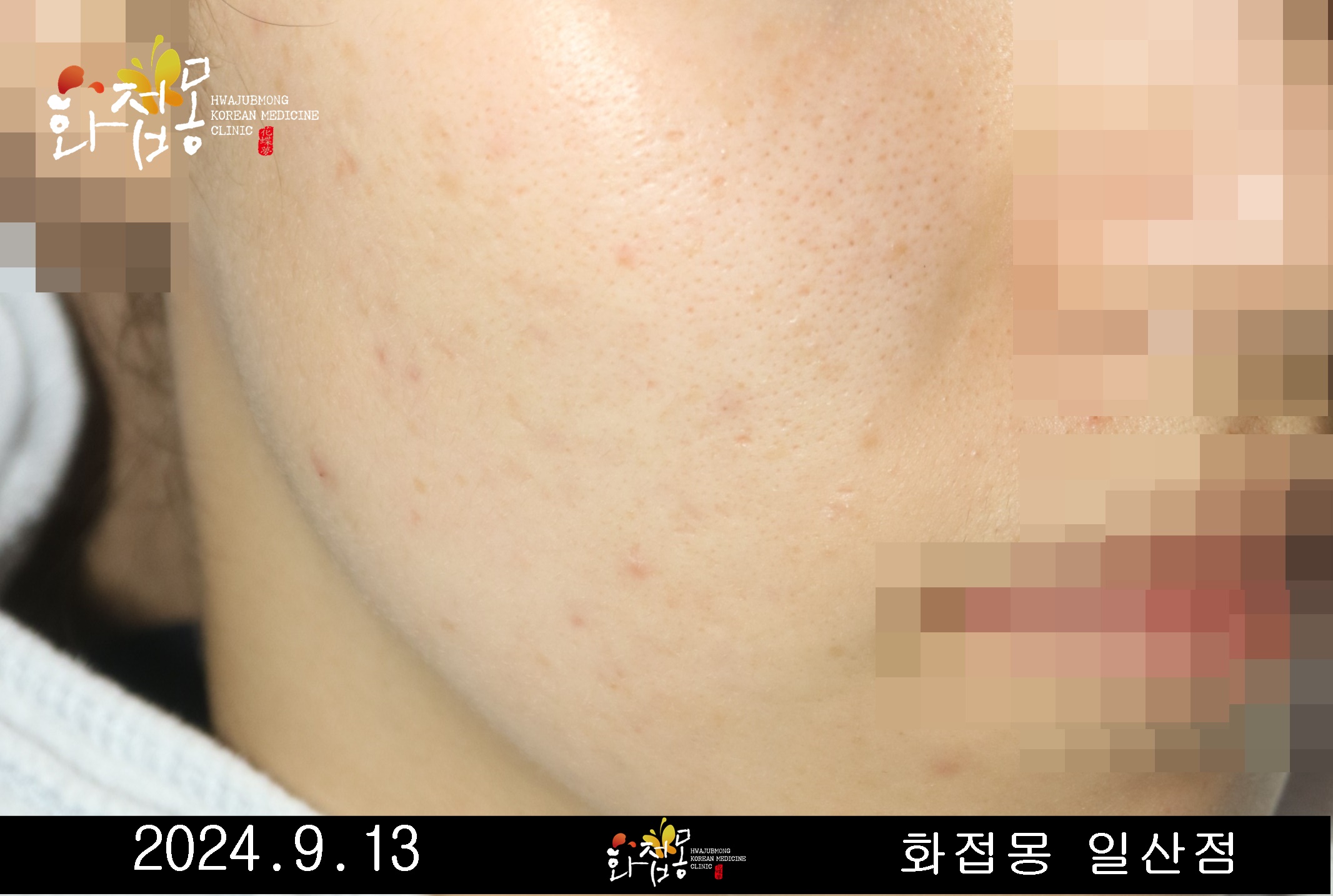 전후사진