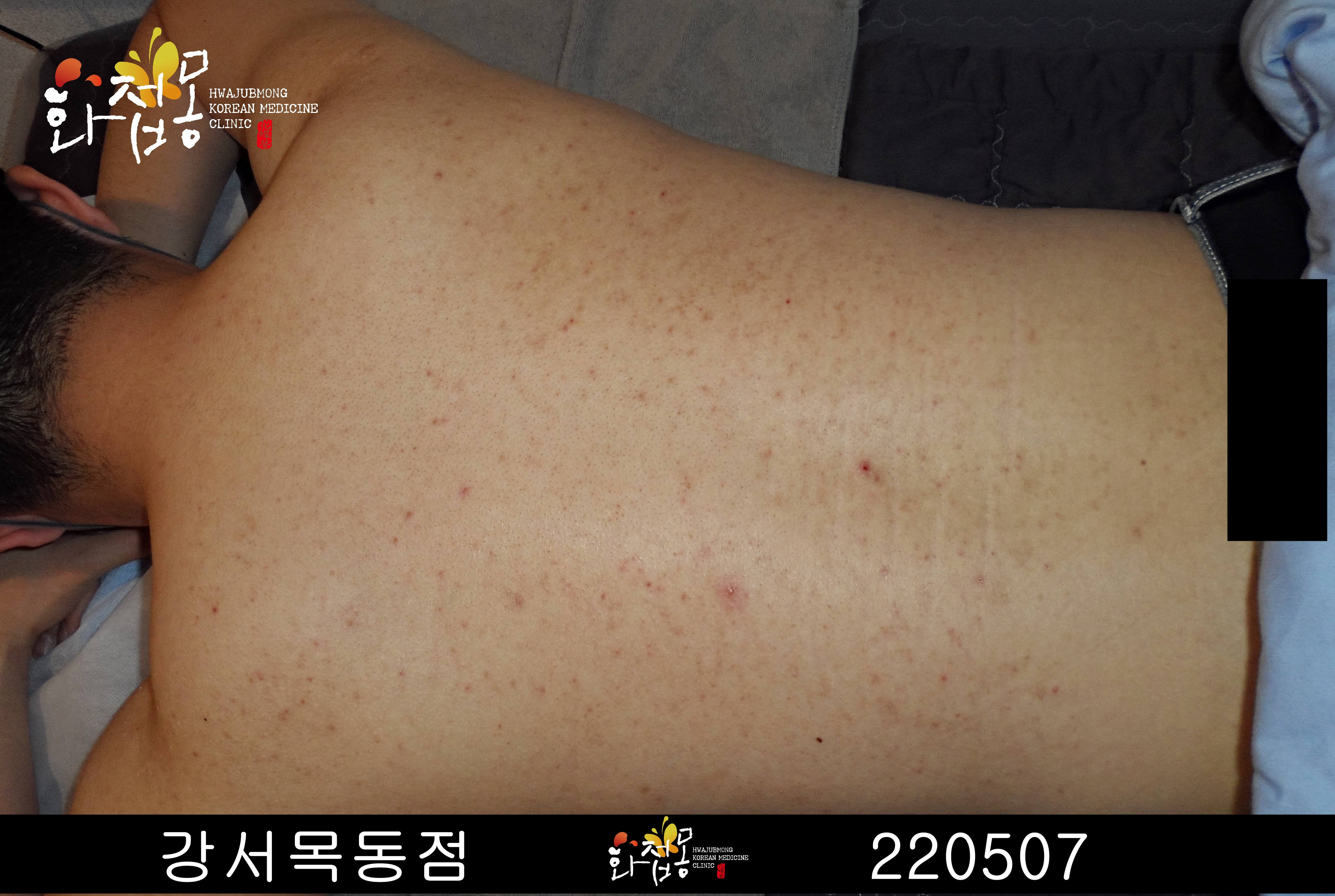 전후사진
