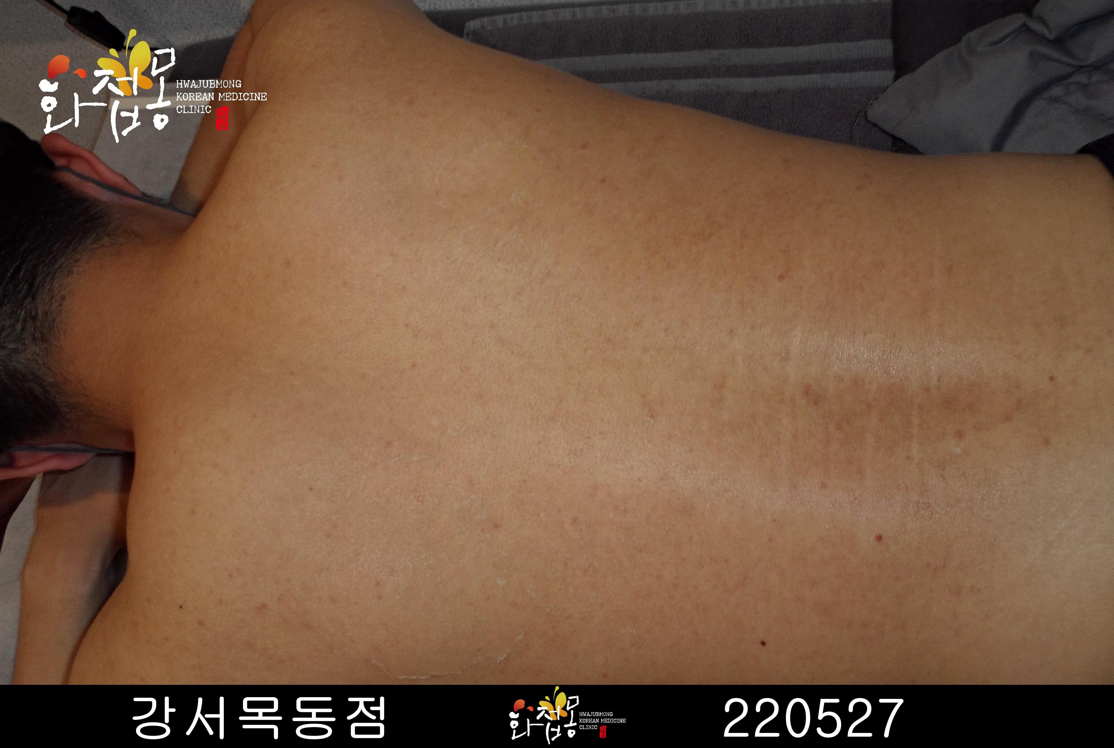 전후사진