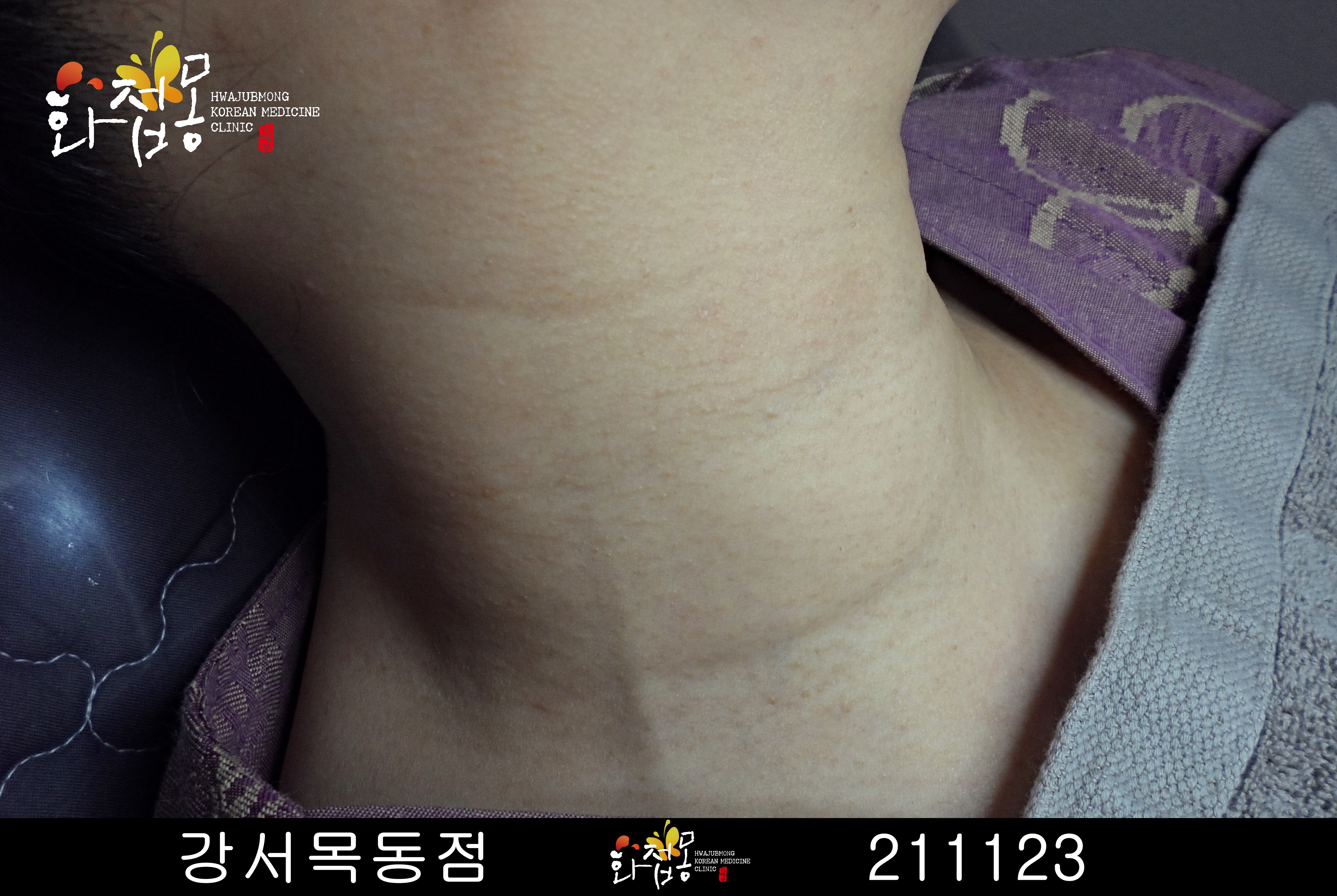 전후사진