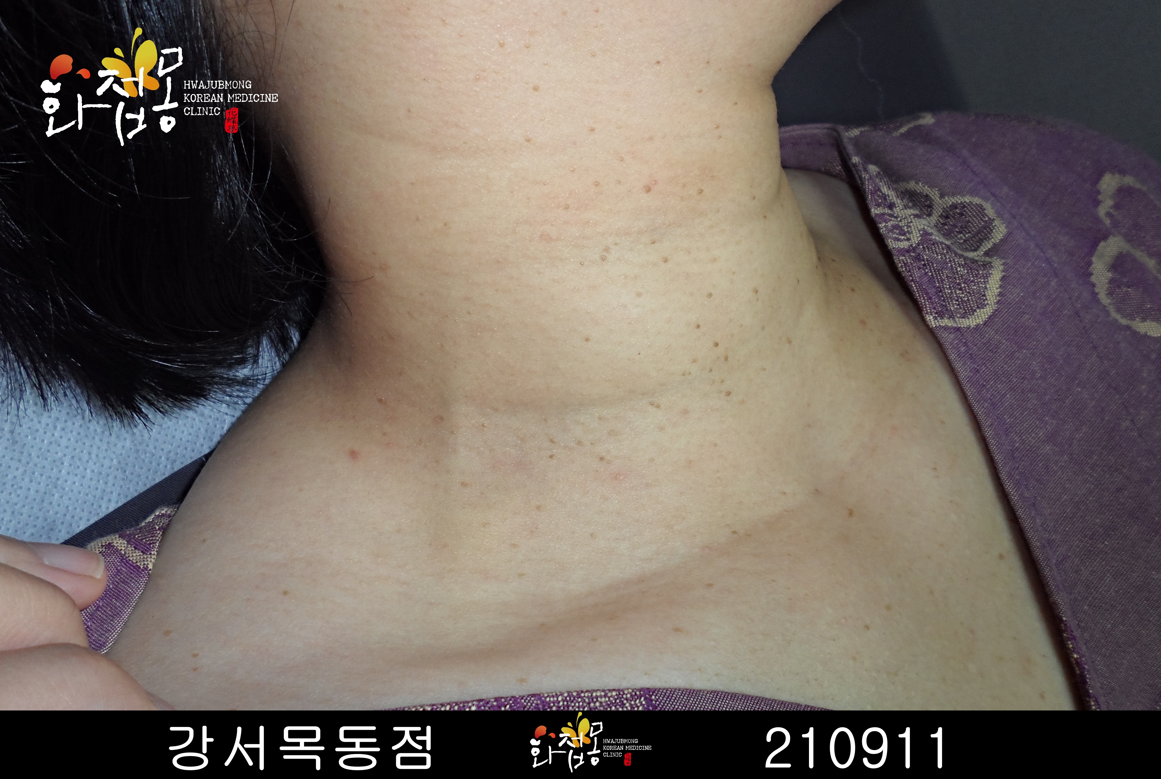 전후사진