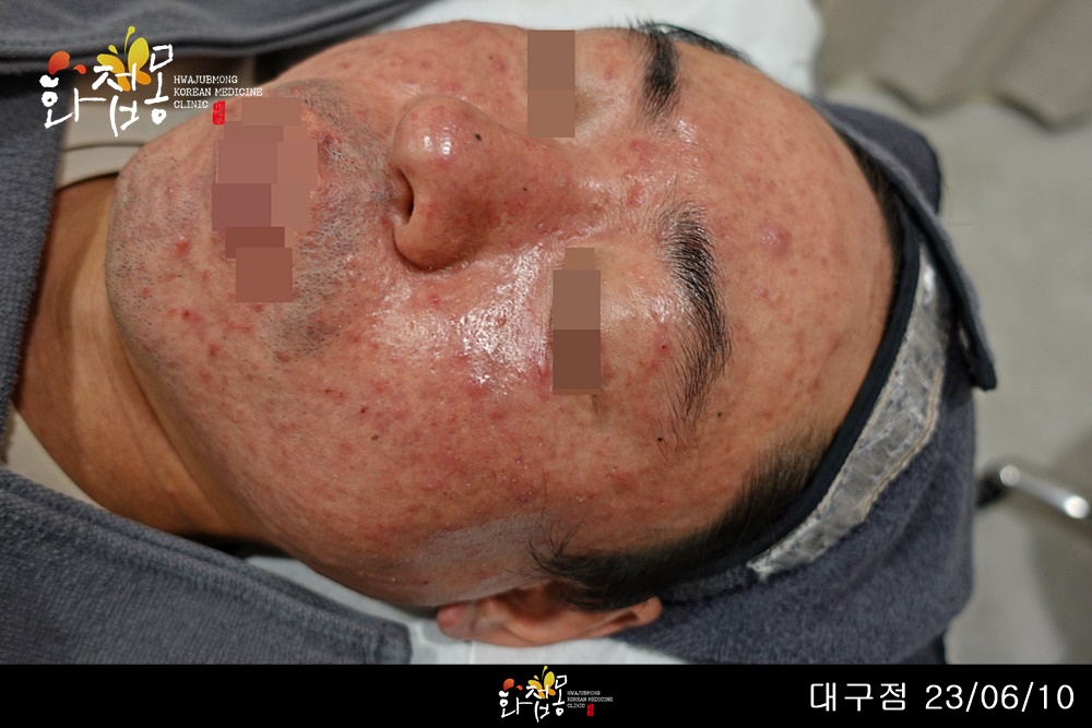 전후사진