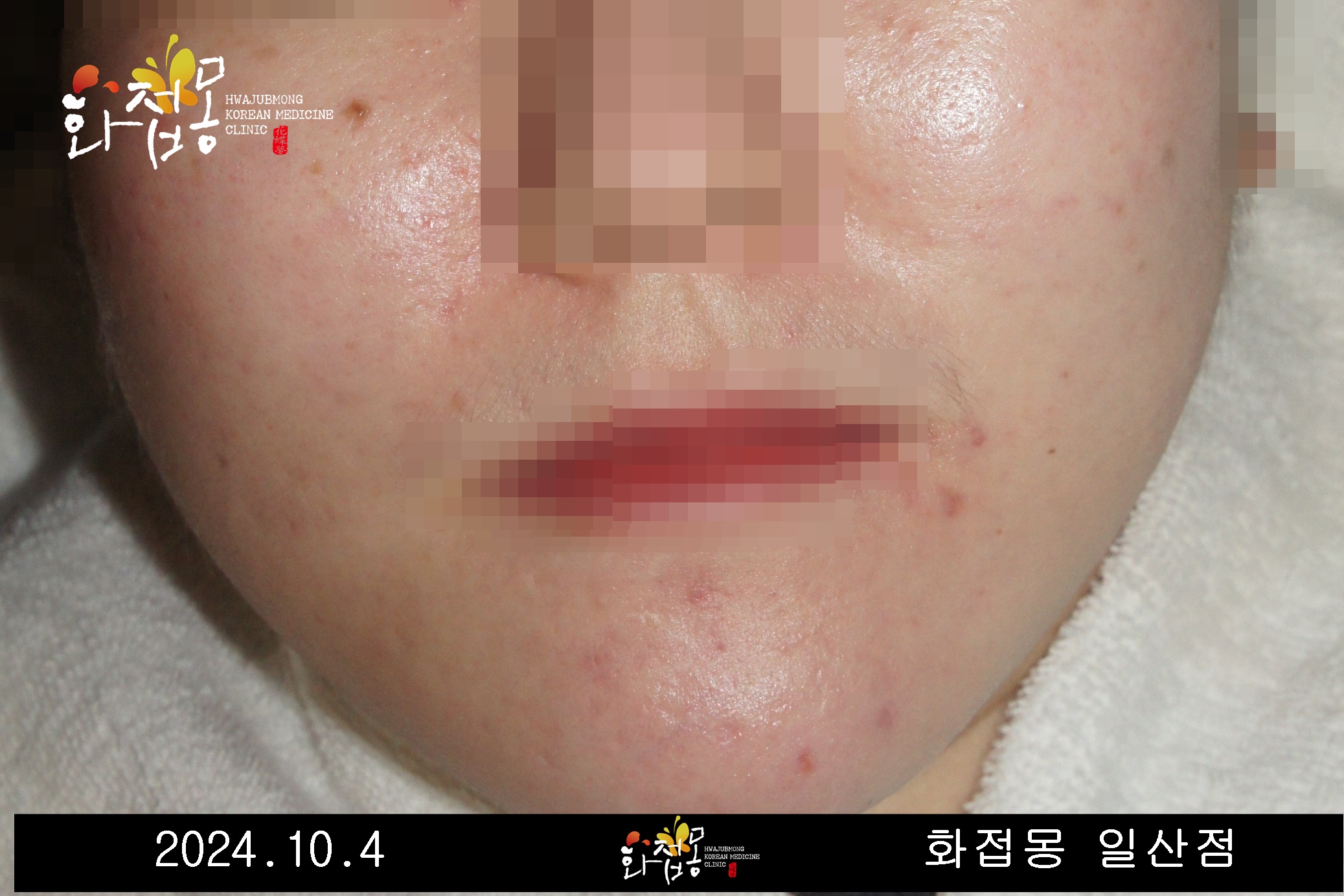 전후사진