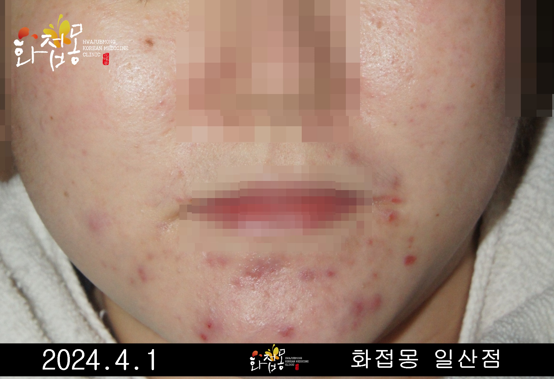 전후사진