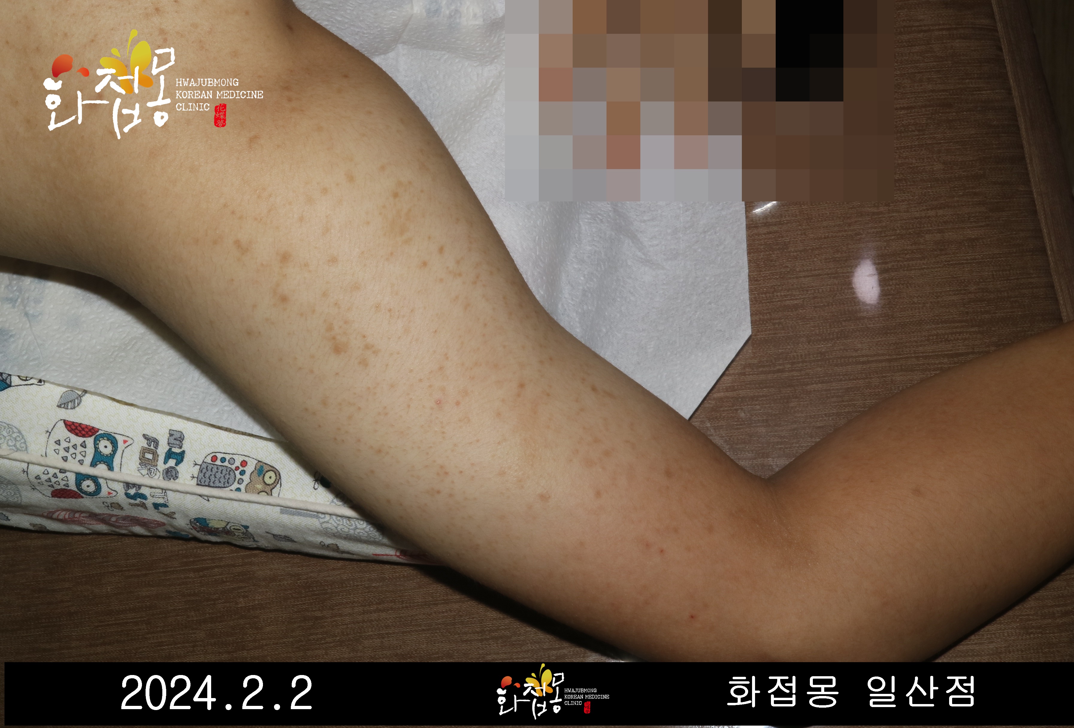 전후사진