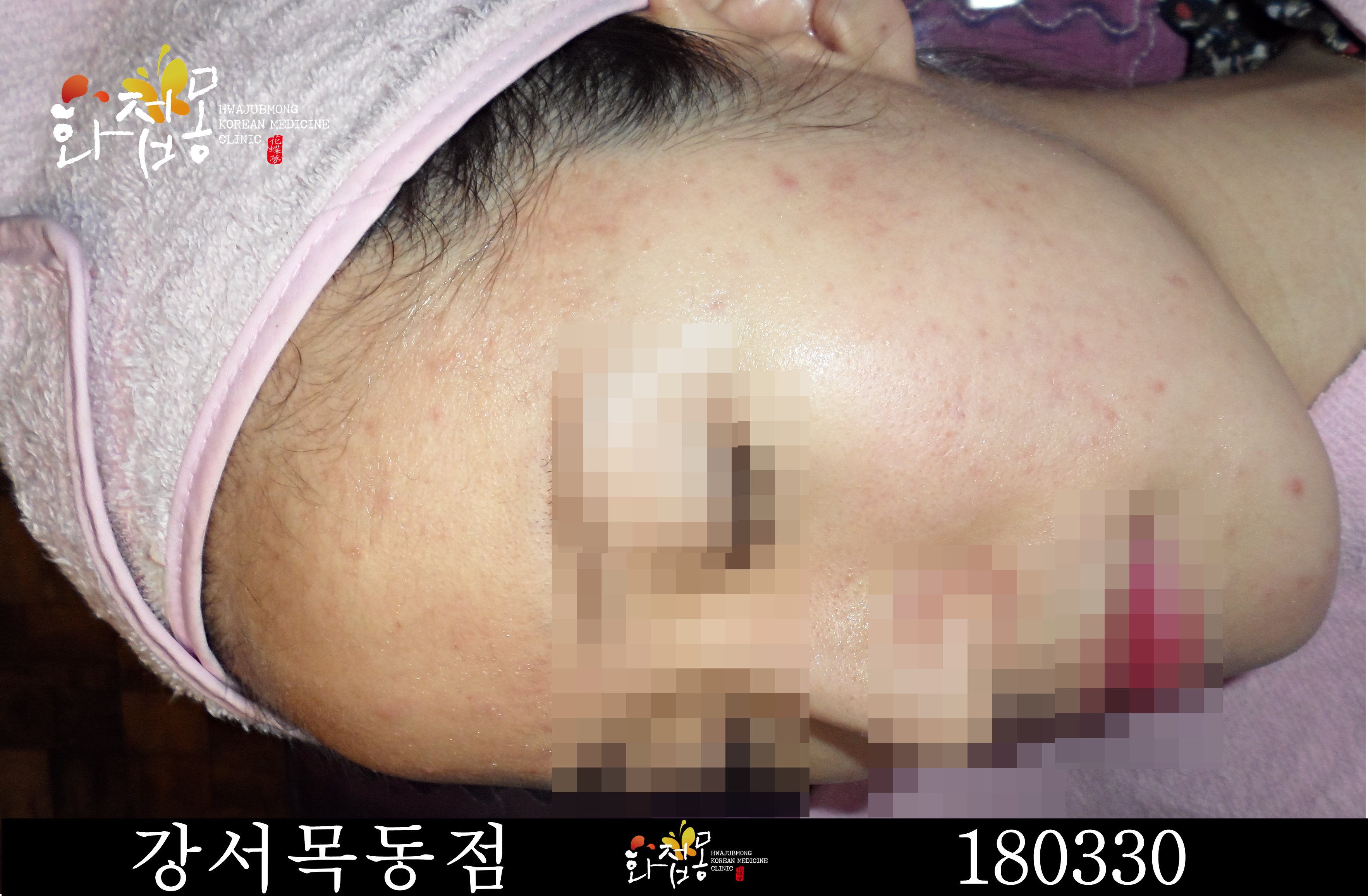 전후사진