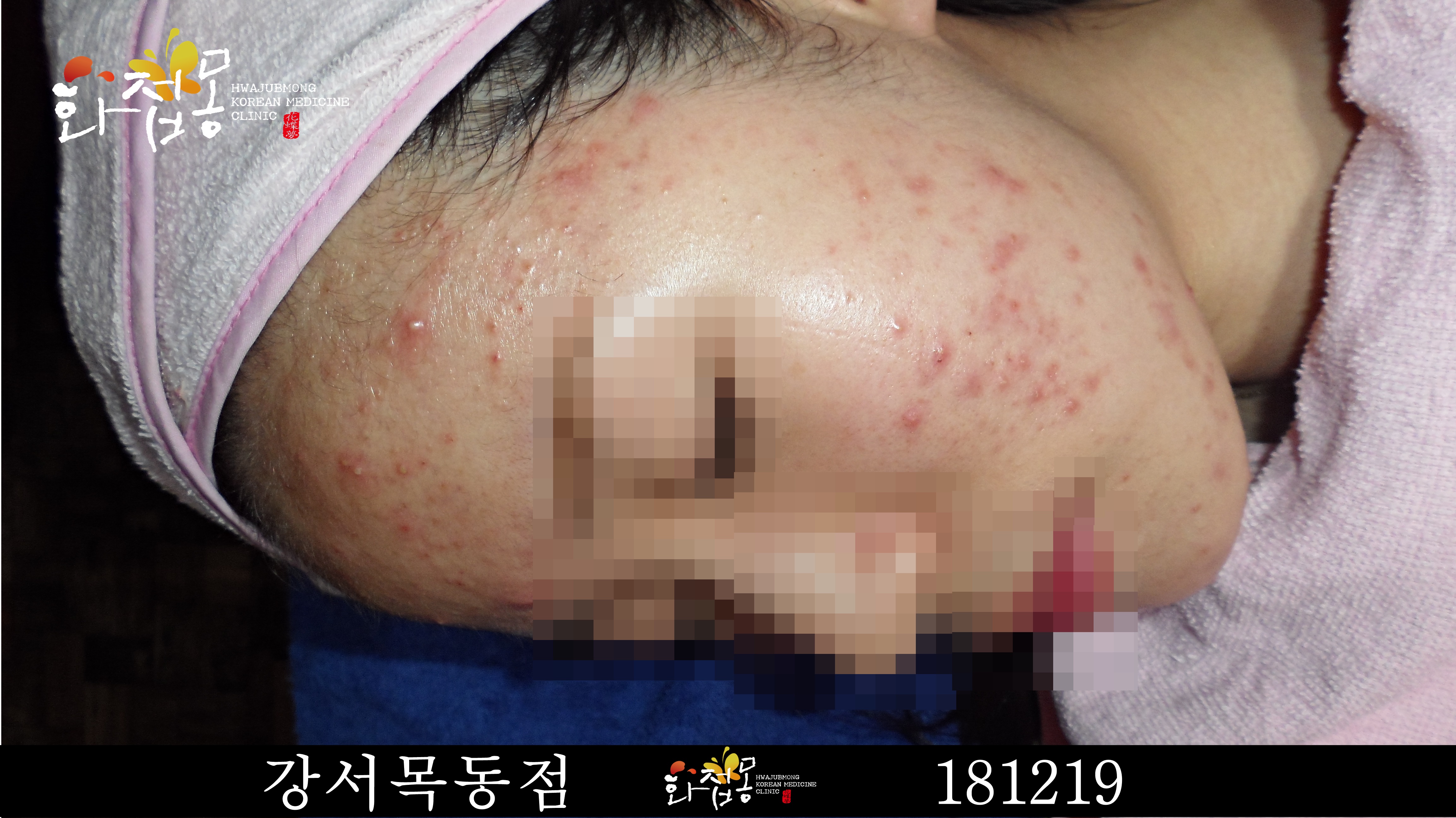 전후사진