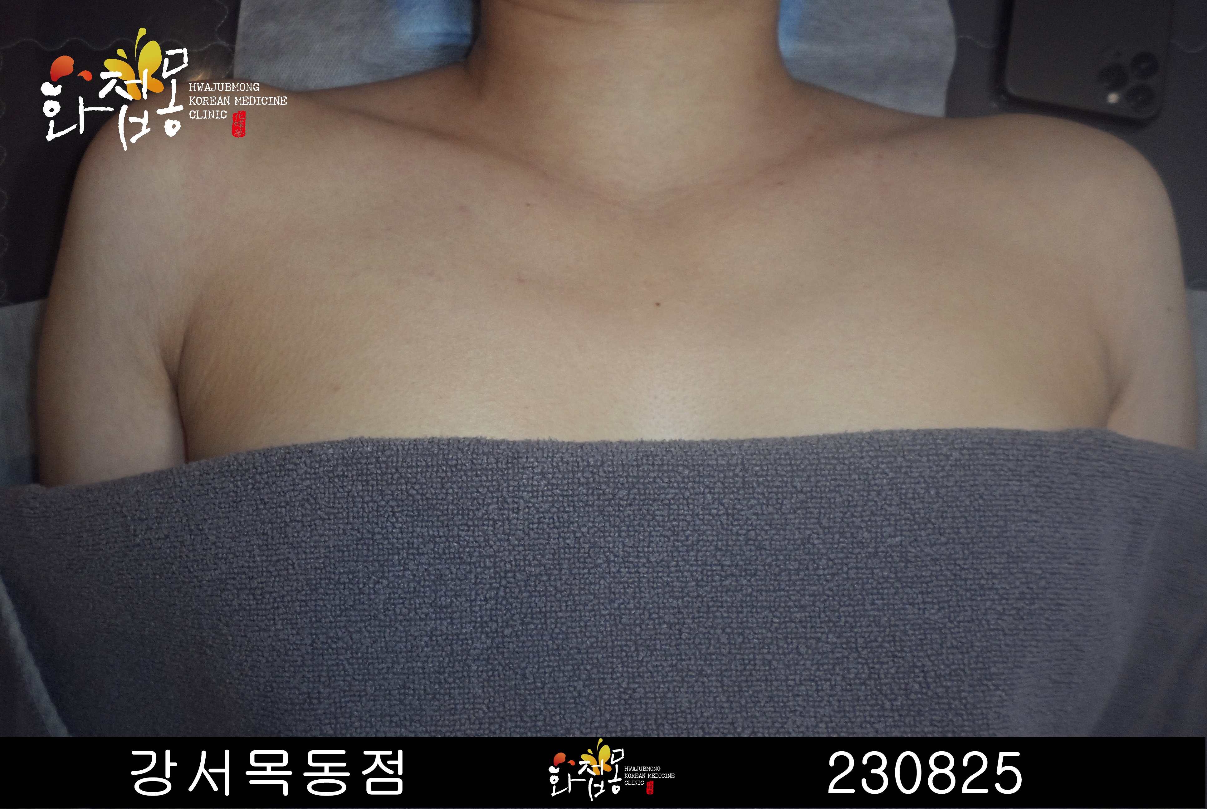 전후사진