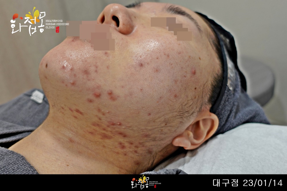 전후사진