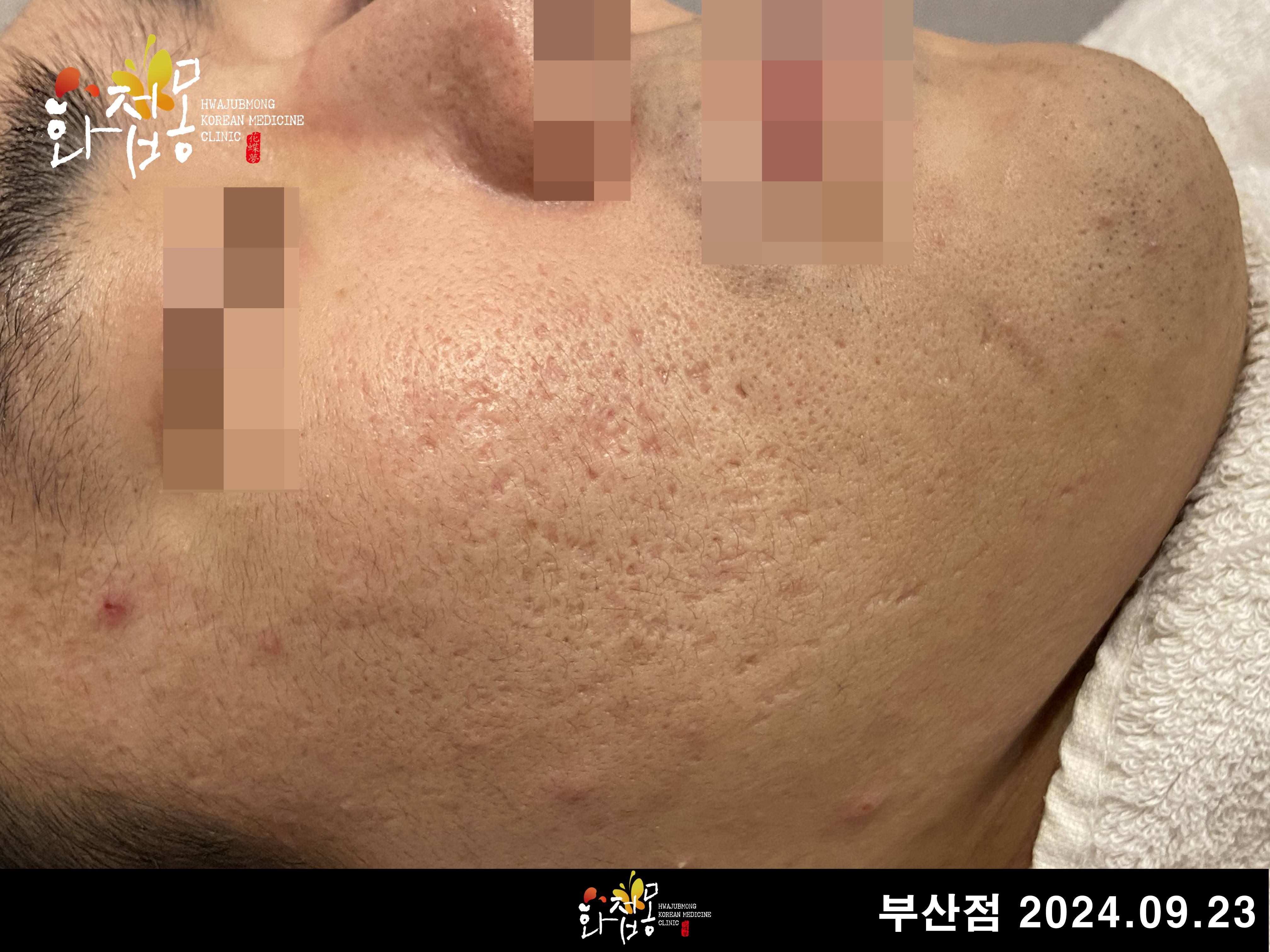 전후사진
