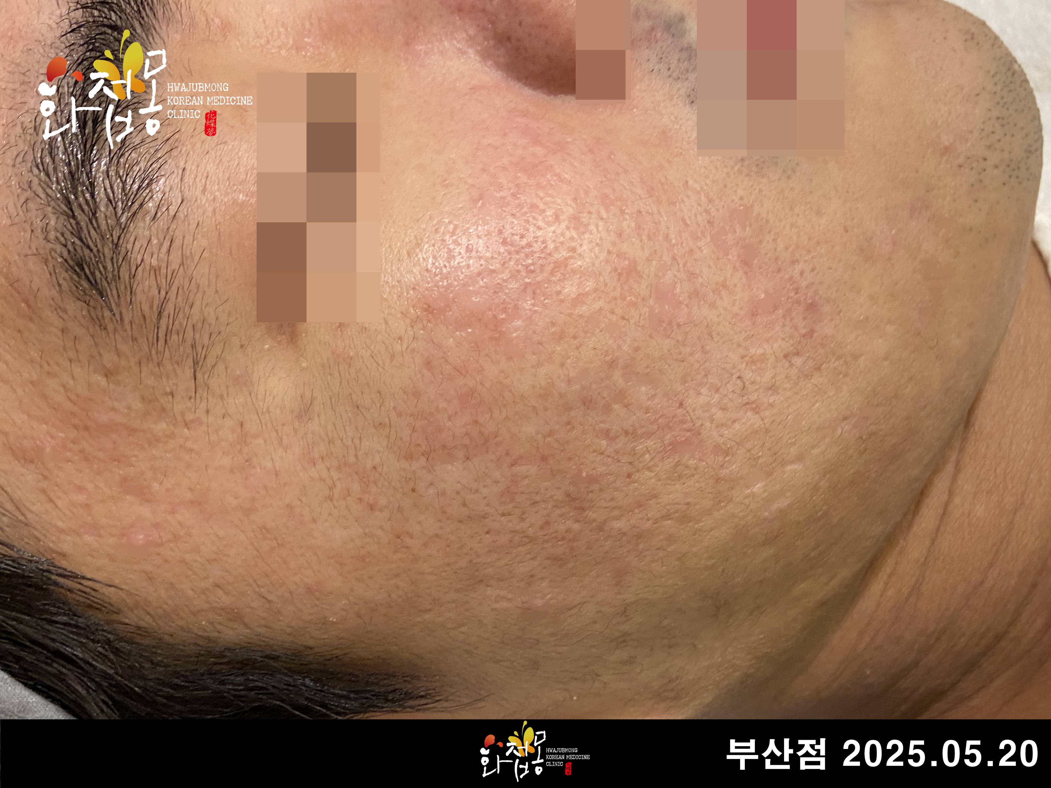 전후사진