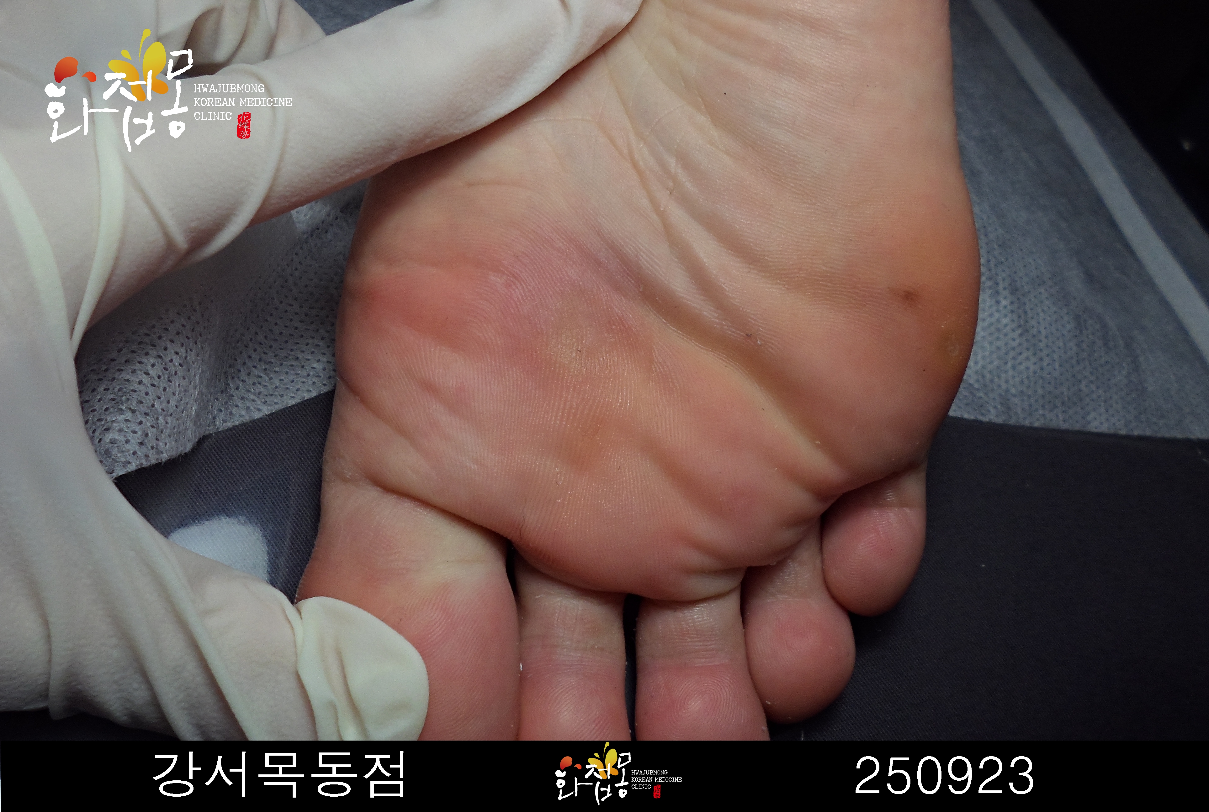 전후사진