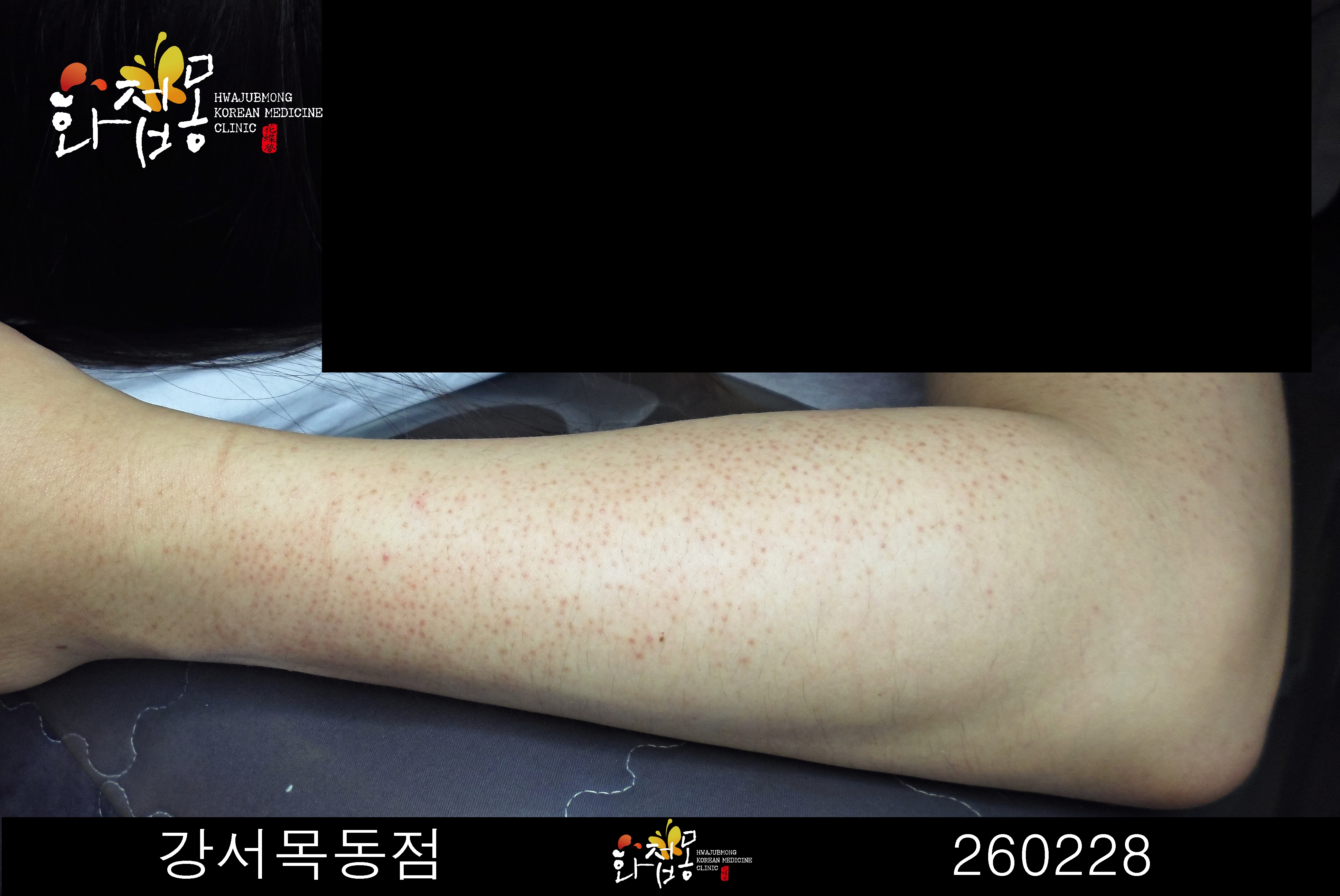 전후사진