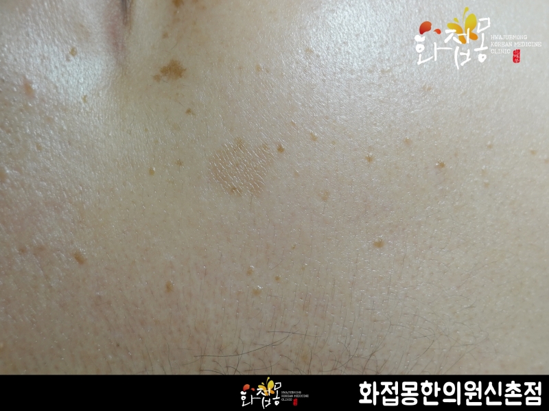 전후사진