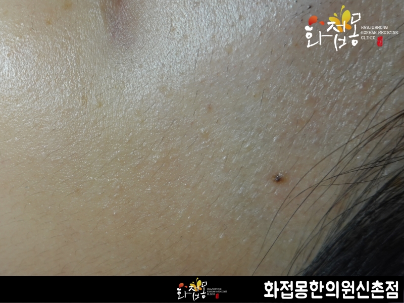 전후사진