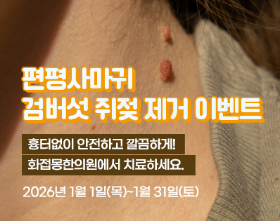 편평사마귀 _39이벤트