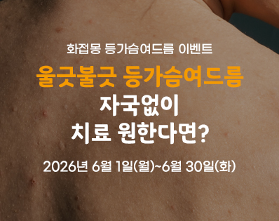 등가슴여드름_이벤트