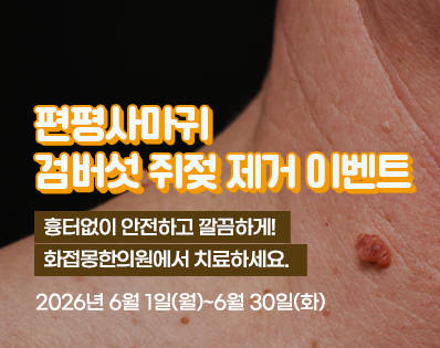 편평사마귀 _29이벤트