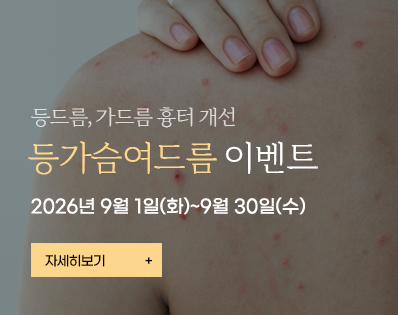 등가슴여드름_이벤트