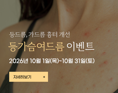 등가슴여드름_이벤트