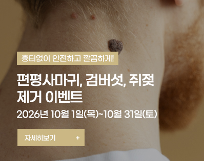 편평사마귀 _39이벤트